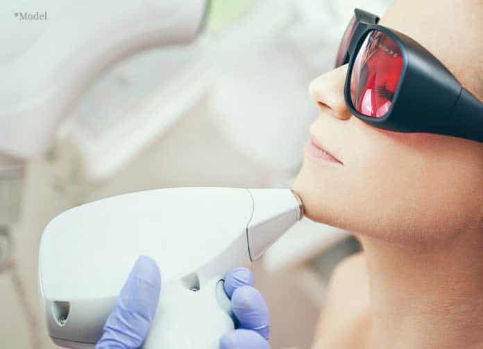 medical professional in blue glove placing laser hair removal device on chin of female patient wearing protective glasses.