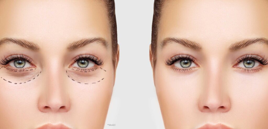 iStock 621828242 scaled 1