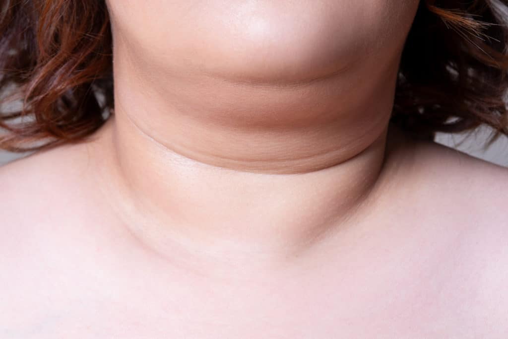 Flabby skin on the neck of an fat woman, female double chin on gray background, wrinkle treatment