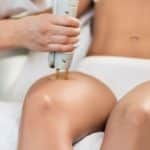 Young woman is having leg hair removal treatment with medical laser.