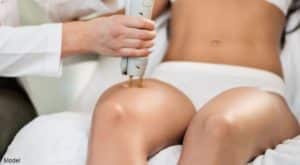 Young woman is having leg hair removal treatment with medical laser.