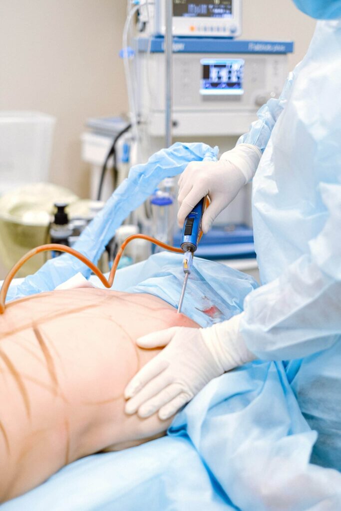 liposuction model