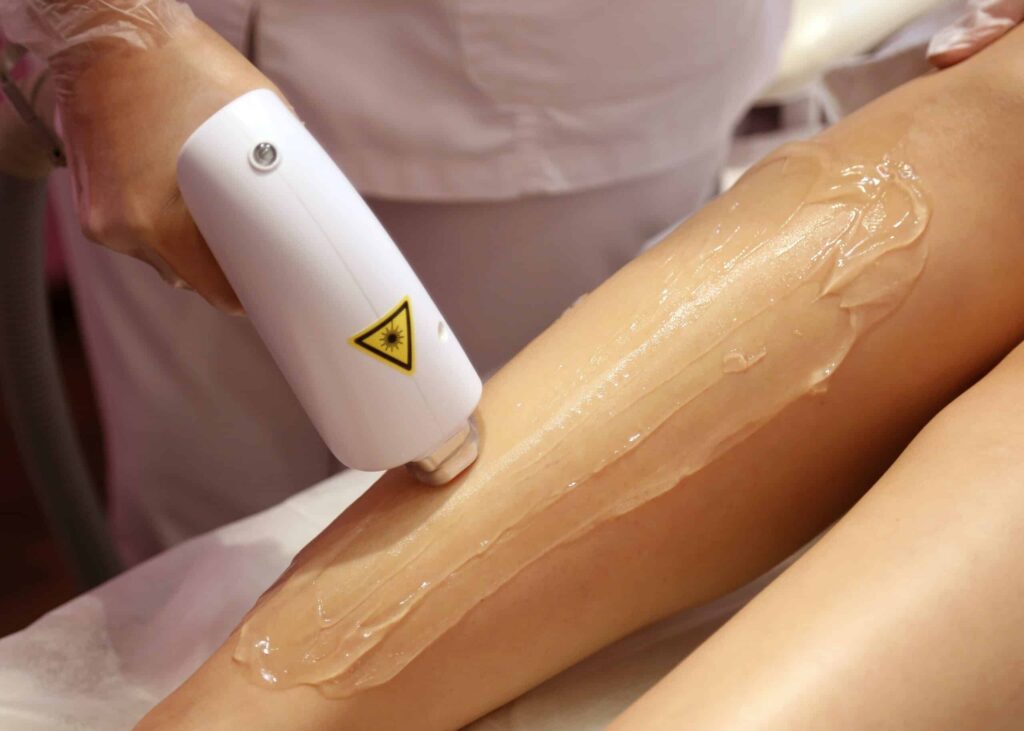 Laser Hair Removal 3 scaled 1