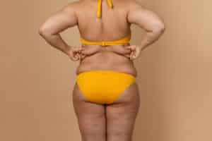 Cropped,Image,Of,Overweight,Fat,Woman,Back,With,Obesity,,Excess Cropped,Image,Of,Overweight,Fat,Woman,Back,With,Obesity,,Excess