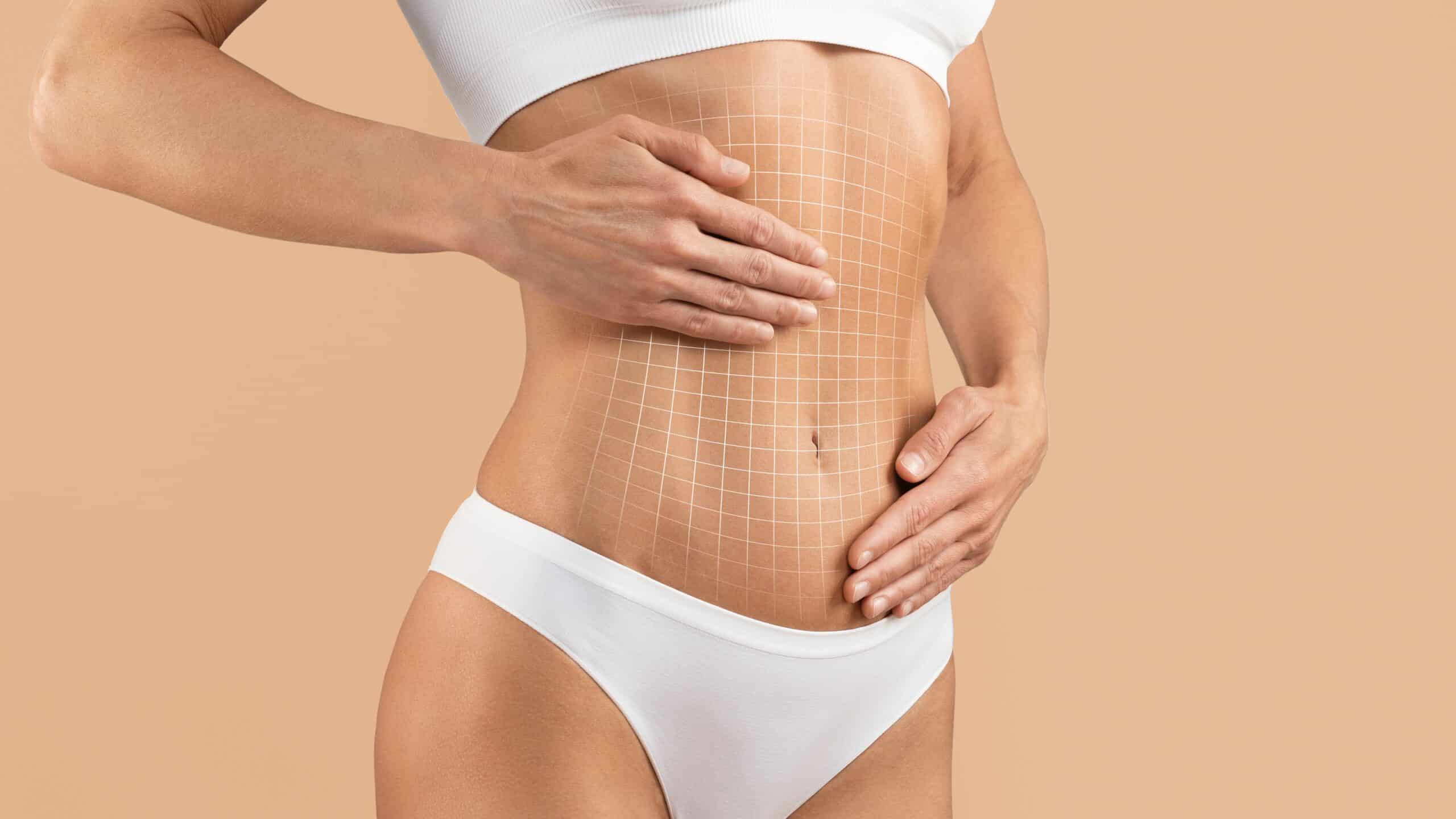 Combining Tummy Tuck and Liposuction for Optimal Body Contouring