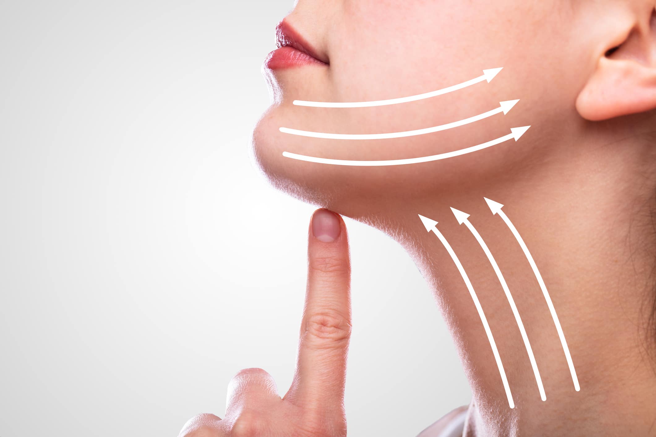 Woman After Face Lifting On Her Face