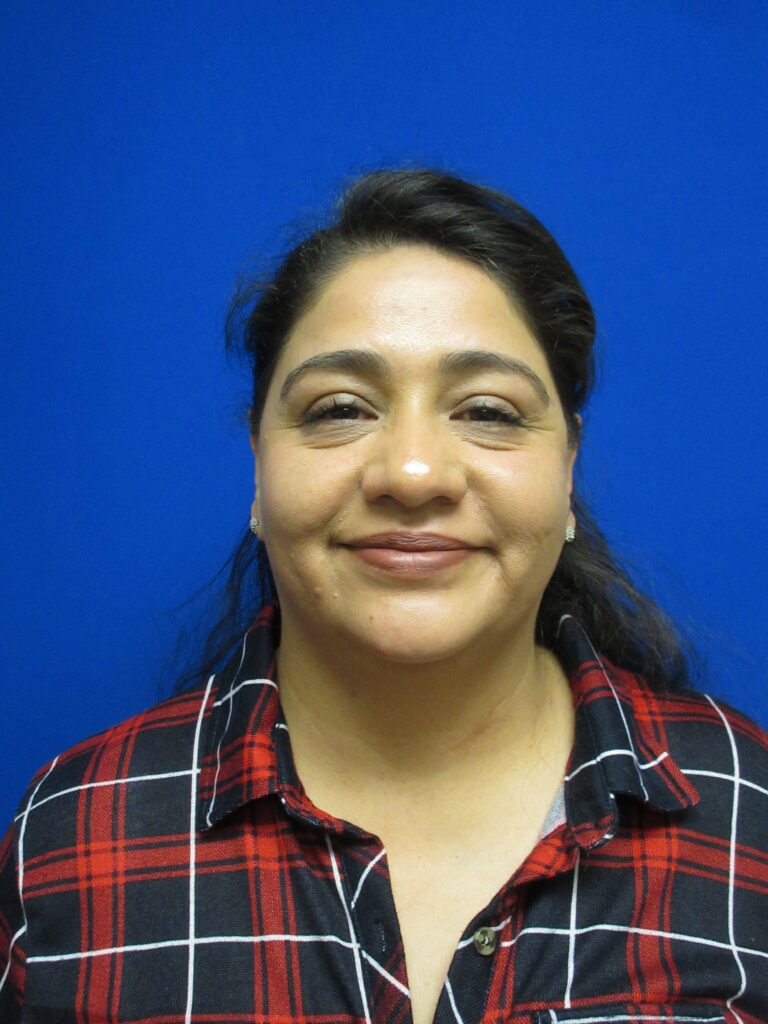 Before Image: Blepharoplasty Patient 12 - front