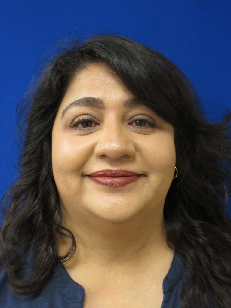After Image: Blepharoplasty Patient 12 - front
