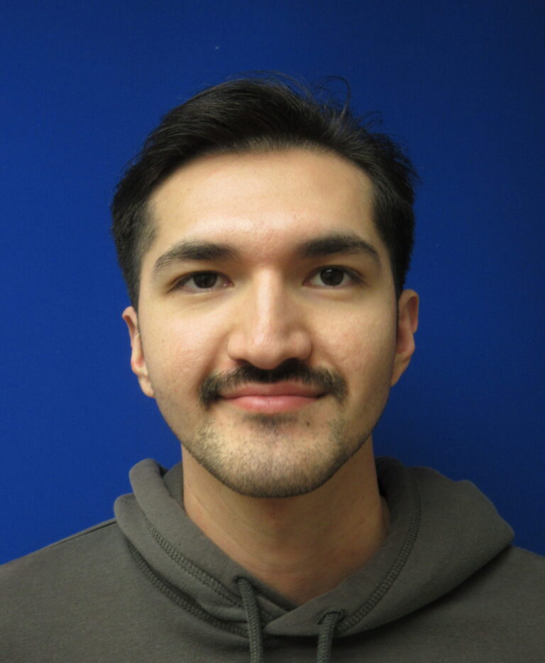 After Image: Otoplasty Patient 6 - front