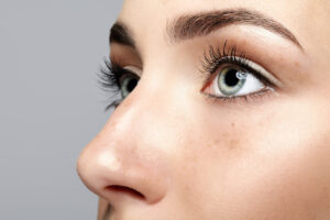 Woman with bright eyes after eyelid surgery in San Antonio, TX